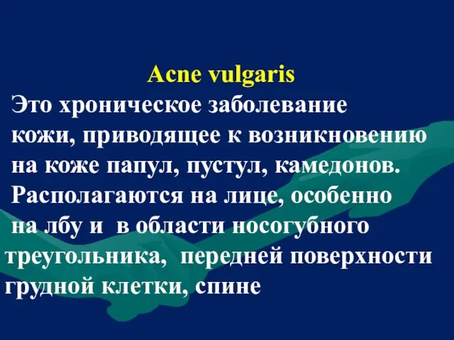 Acne vulgaris Это хроническое заболевание кожи, приводящее к возникновению на