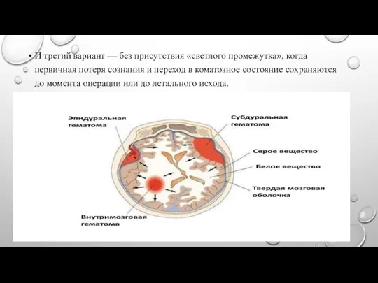 И третий вариант — без присутствия «светлого промежутка», когда первичная