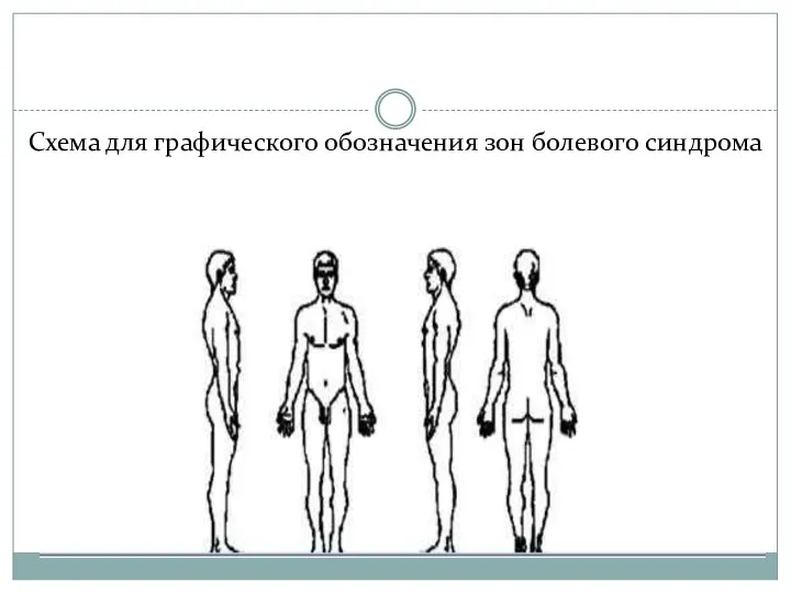 Схема для графического обозначения зон болевого синдрома