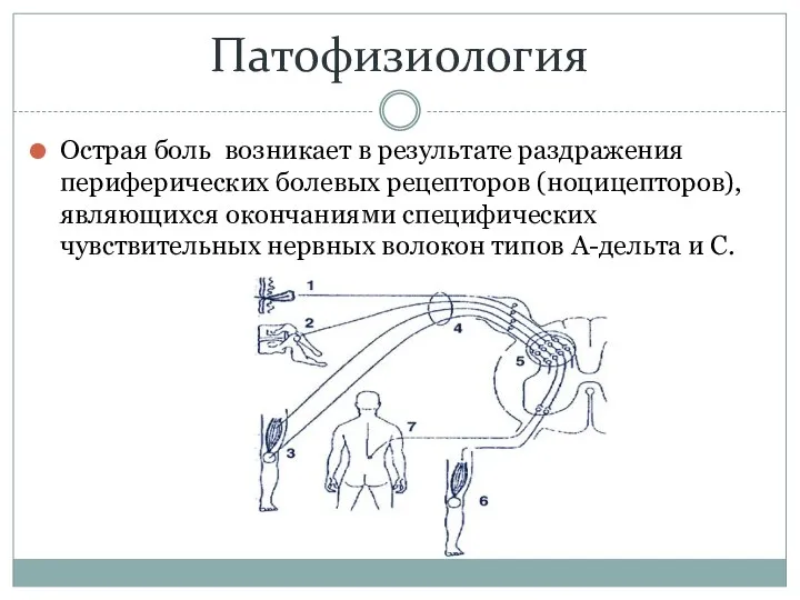 Патофизиология Острая боль возникает в результате раздражения периферических болевых рецепторов