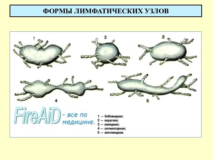 ФОРМЫ ЛИМФАТИЧЕСКИХ УЗЛОВ