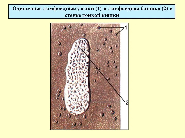 Одиночные лимфоидные узелки (1) и лимфоидная бляшка (2) в стенке тонкой кишки