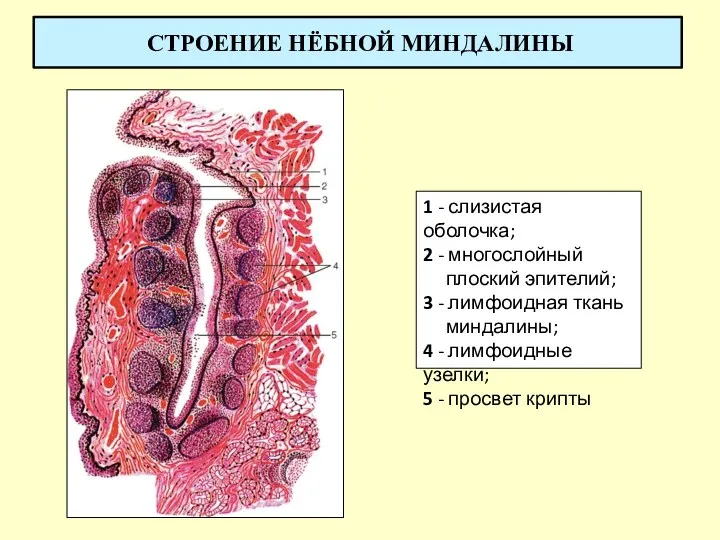 СТРОЕНИЕ НЁБНОЙ МИНДАЛИНЫ 1 - слизистая оболочка; 2 - многослойный