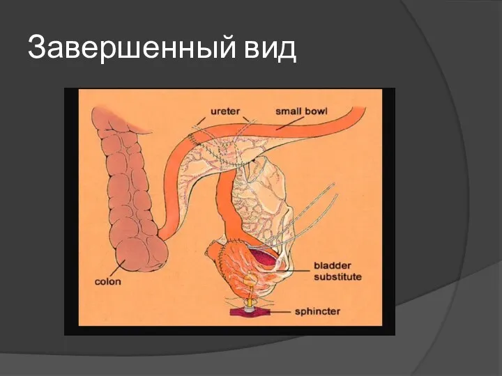 Завершенный вид