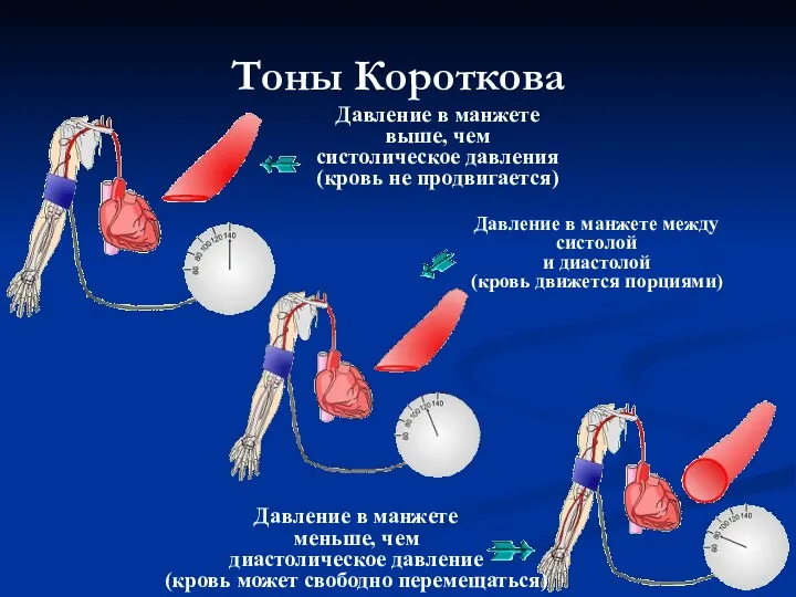 Тоны Короткова Давление в манжете между систолой и диастолой (кровь