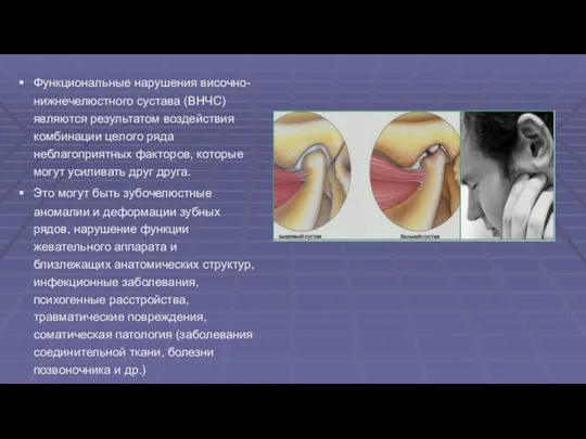 Функциональные нарушения височно-нижнечелюстного сустава (ВНЧС) являются результатом воздействия комбинации целого