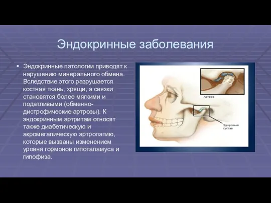 Эндокринные заболевания Эндокринные патологии приводят к нарушению минерального обмена. Вследствие