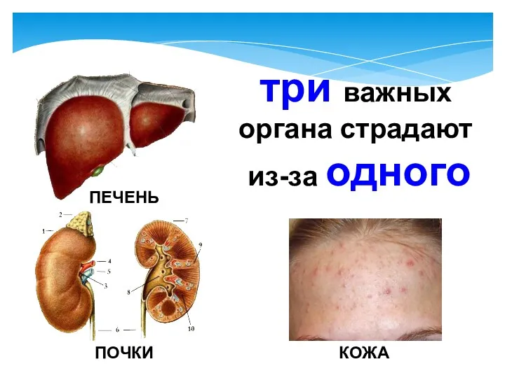 три важных органа страдают из-за одного ПЕЧЕНЬ ПОЧКИ КОЖА