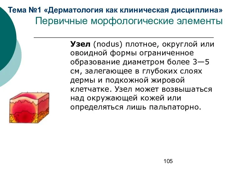 Тема №1 «Дерматология как клиническая дисциплина» Первичные морфологические элементы Узел