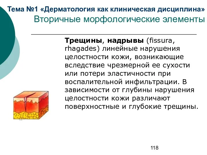 Тема №1 «Дерматология как клиническая дисциплина» Вторичные морфологические элементы Трещины,