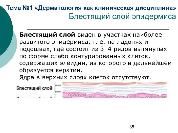 Тема №1 «Дерматология как клиническая дисциплина» Блестящий слой эпидермиса Блестящий