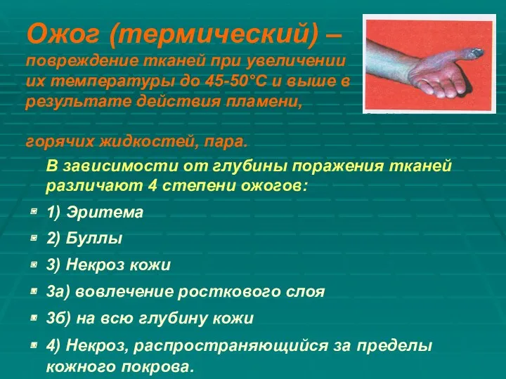 Ожог (термический) – повреждение тканей при увеличении их температуры до 45-50°С и выше