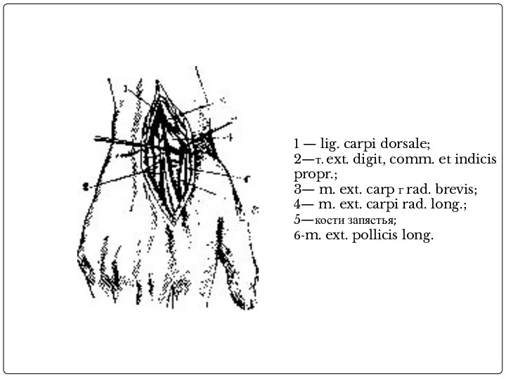 1 — lig. carpi dorsale; 2—т. ext. digit, comm. et