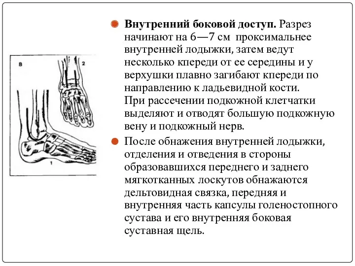 Внутренний боковой доступ. Разрез начинают на 6—7 см проксимальнее внутренней