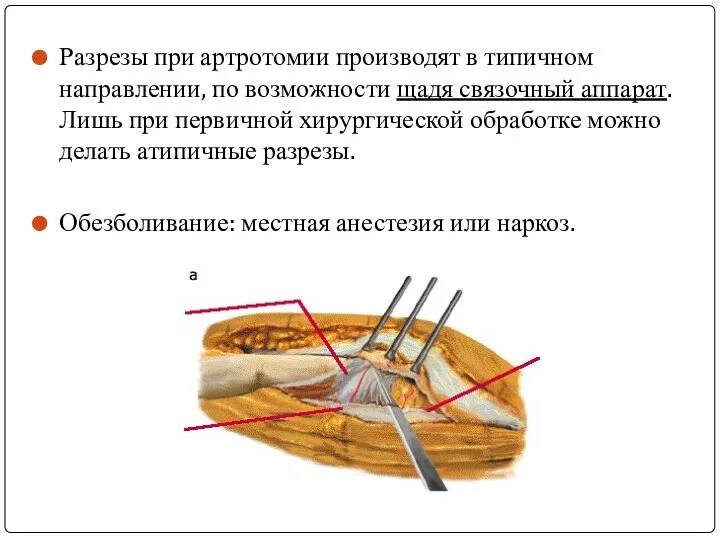 Разрезы при артротомии производят в типичном направлении, по возможности щадя