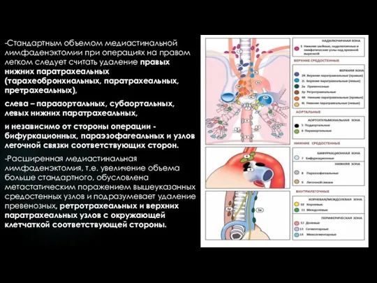 -Стандартным объемом медиастинальной лимфаденэктомии при операциях на правом легком следует