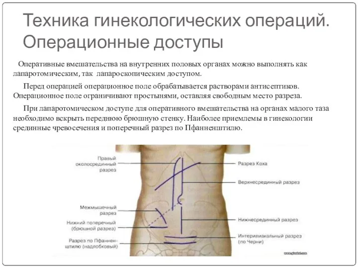 Техника гинекологических операций. Операционные доступы Оперативные вмешательства на внутренних половых