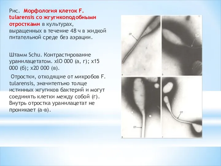 Рис. Морфология клеток F. tularensis со жгугикоподобными отростками в культурах,