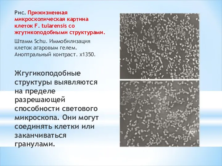 Рис. Прижизненная микроскопическая картина клеток F. tularensis со жгутикоподобными структурами. Штамм Schu. Иммобилизация