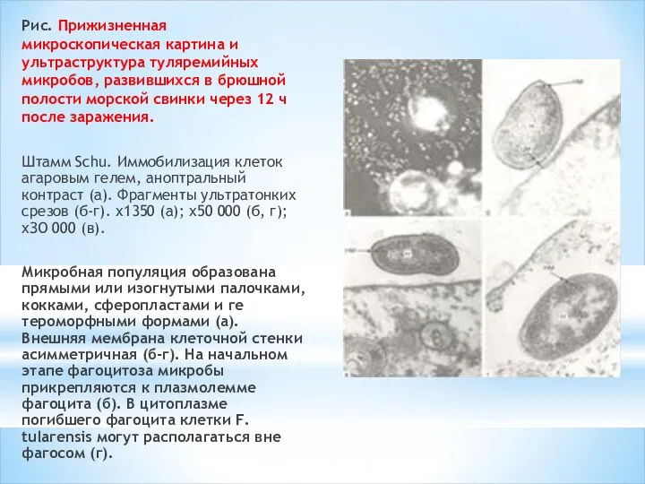 Рис. Прижизненная микроскопическая картина и ультраструктура туляремийных микробов, развившихся в