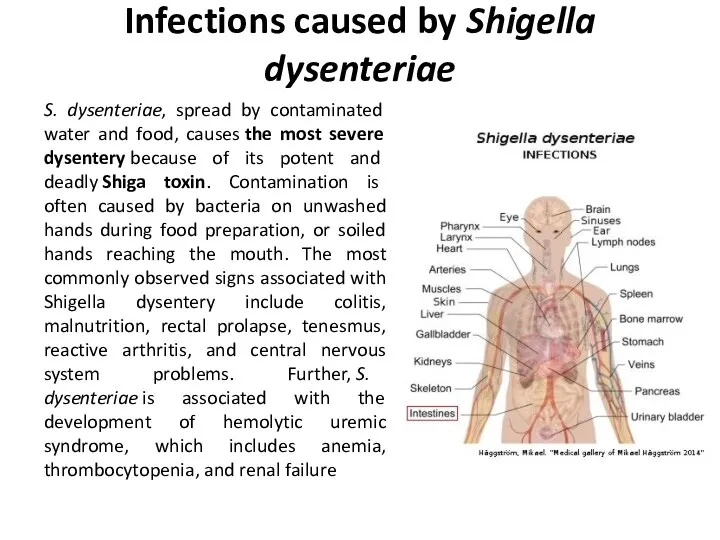 Infections caused by Shigella dysenteriae S. dysenteriae, spread by contaminated