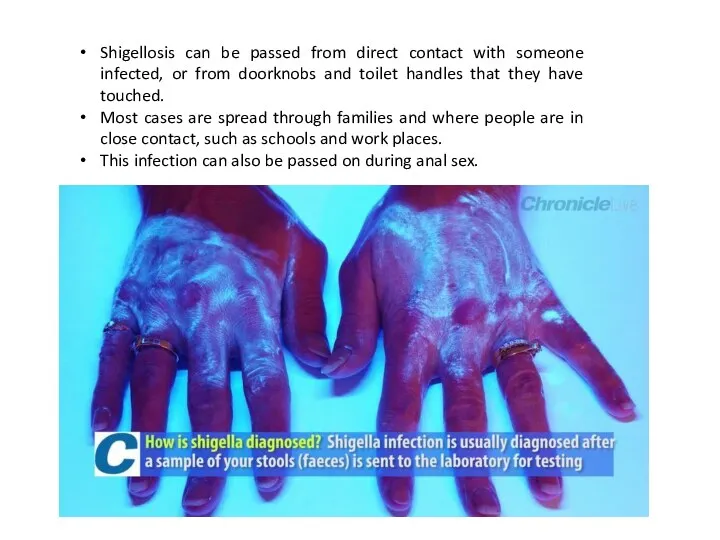 Shigellosis can be passed from direct contact with someone infected,
