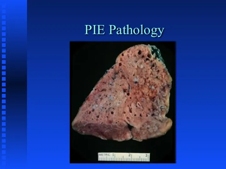 PIE Pathology