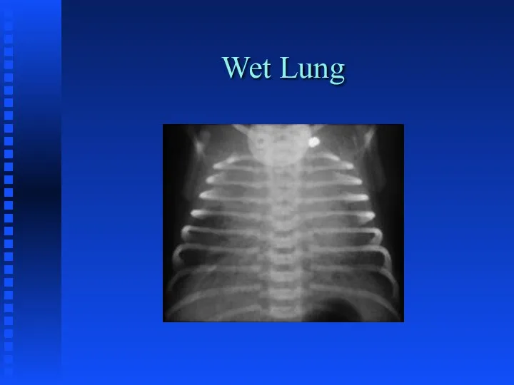 Wet Lung