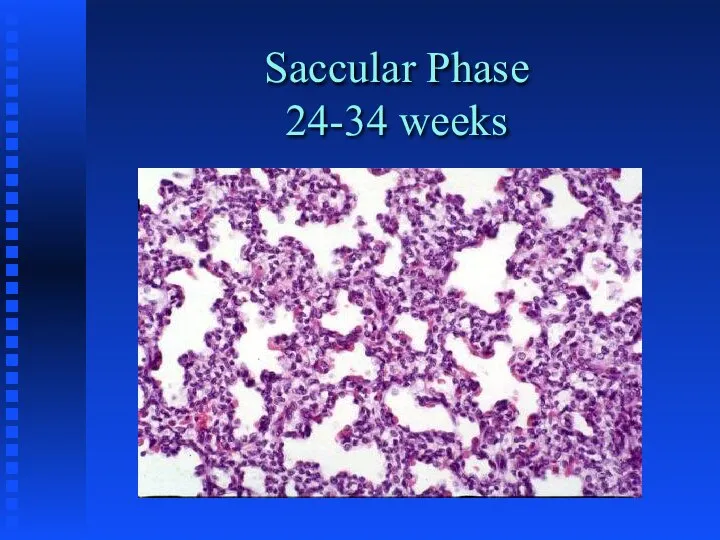 Saccular Phase 24-34 weeks