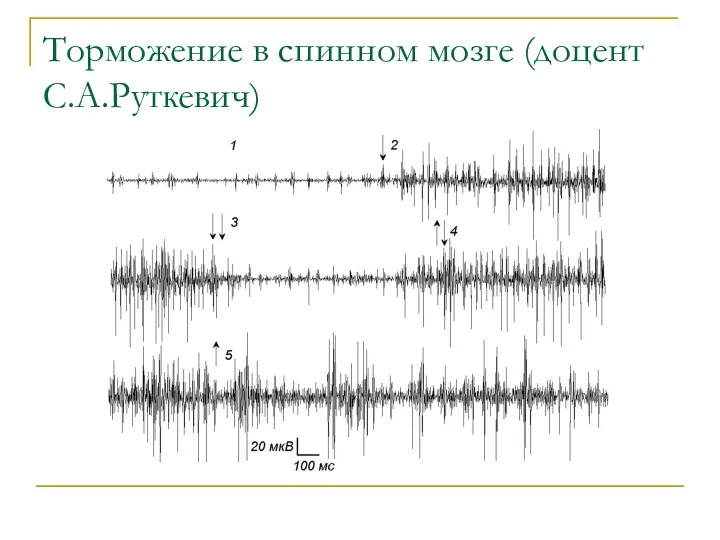 Торможение в спинном мозге (доцент С.А.Руткевич)