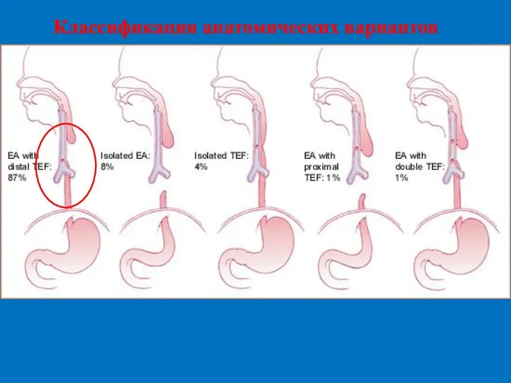 Классификация анатомических вариантов