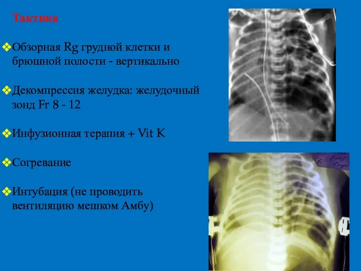 Тактика Обзорная Rg грудной клетки и брюшной полости - вертикально