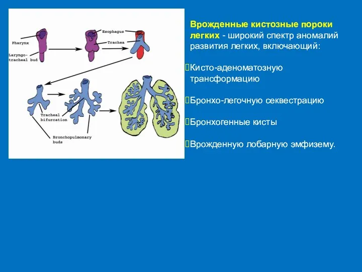 Врожденные кистозные пороки легких - широкий спектр аномалий развития легких,