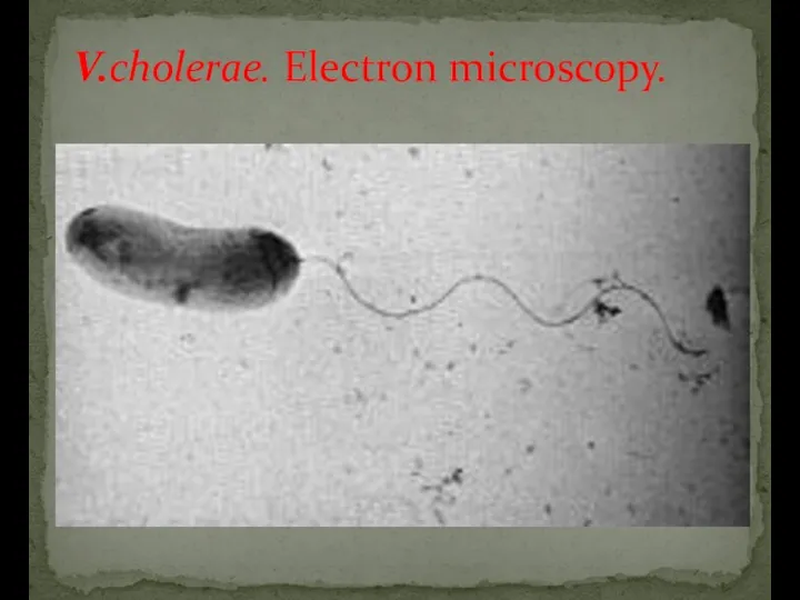 V.cholerae. Electron microscopy.