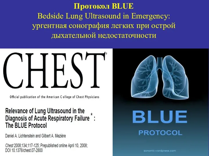 Протокол BLUE Bedside Lung Ultrasound in Emergency: ургентная сонография легких при острой дыхательной недостаточности