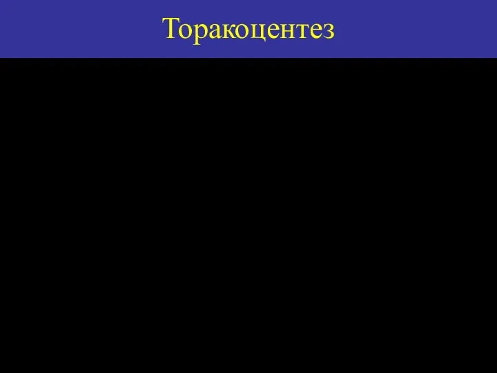 Торакоцентез