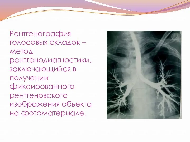 Рентгенография голосовых складок – метод рентгенодиагностики, заключающийся в получении фиксированного рентгеновского изображения объекта на фотоматериале.