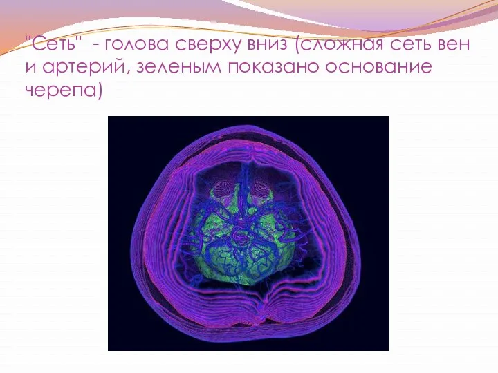 "Сеть" - голова сверху вниз (сложная сеть вен и артерий, зеленым показано основание черепа)