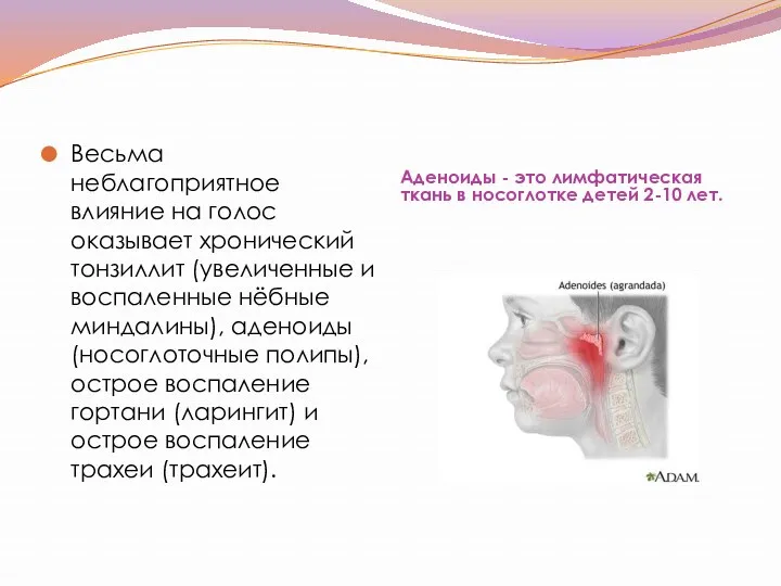 Аденоиды - это лимфатическая ткань в носоглотке детей 2-10 лет.