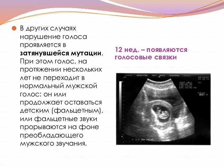 12 нед. – появляются голосовые связки В других случаях нарушение