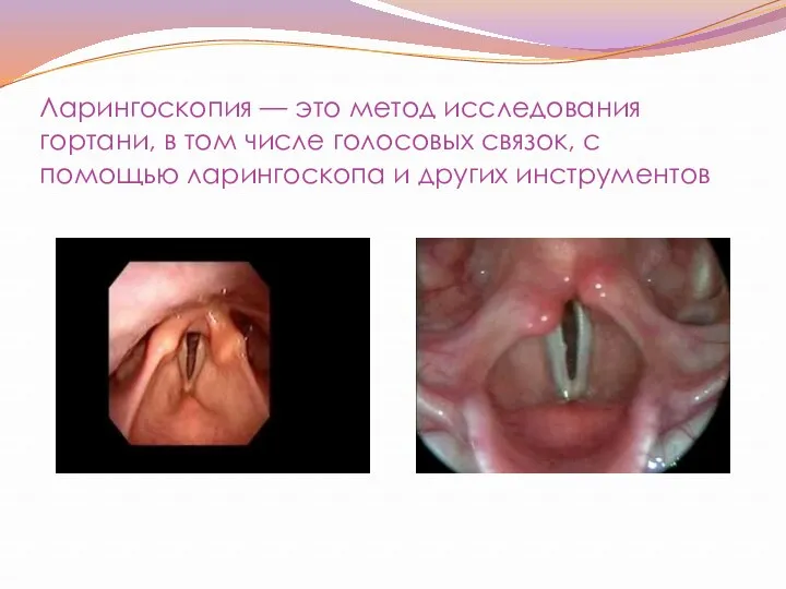 Ларингоскопия — это метод исследования гортани, в том числе голосовых