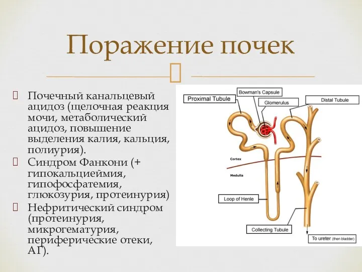 Почечный канальцевый ацидоз (щелочная реакция мочи, метаболический ацидоз, повышение выделения