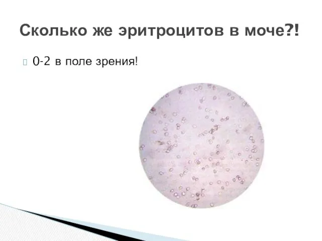 0-2 в поле зрения! Сколько же эритроцитов в моче?!