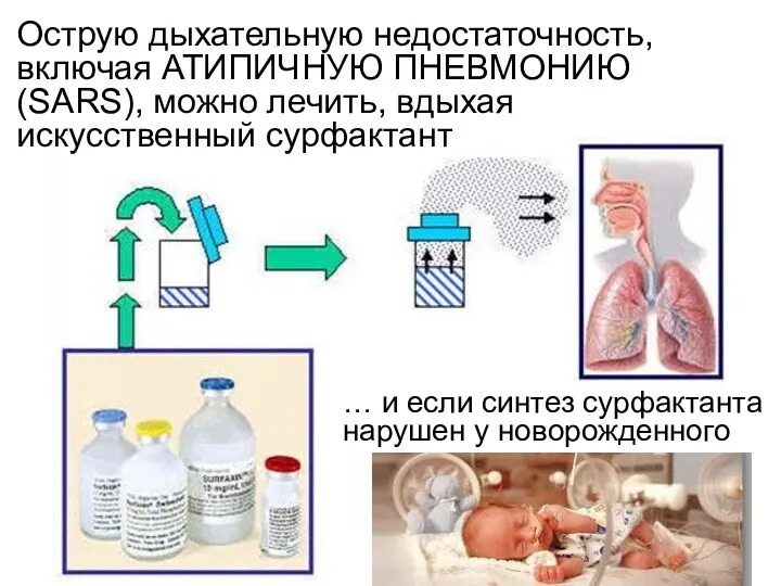 Острую дыхательную недостаточность, включая АТИПИЧНУЮ ПНЕВМОНИЮ (SARS), можно лечить, вдыхая