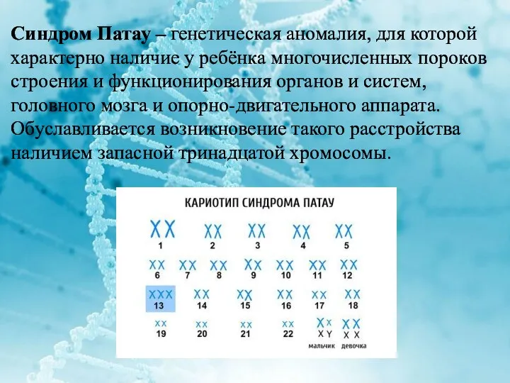 Синдром Патау – генетическая аномалия, для которой характерно наличие у ребёнка многочисленных пороков