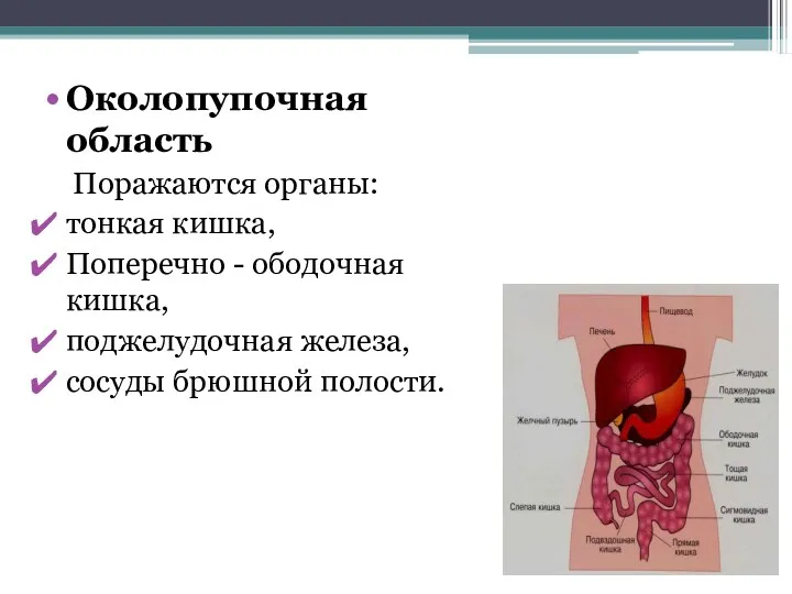 Околопупочная область Поражаются органы: тонкая кишка, Поперечно - ободочная кишка, поджелудочная железа, сосуды брюшной полости.