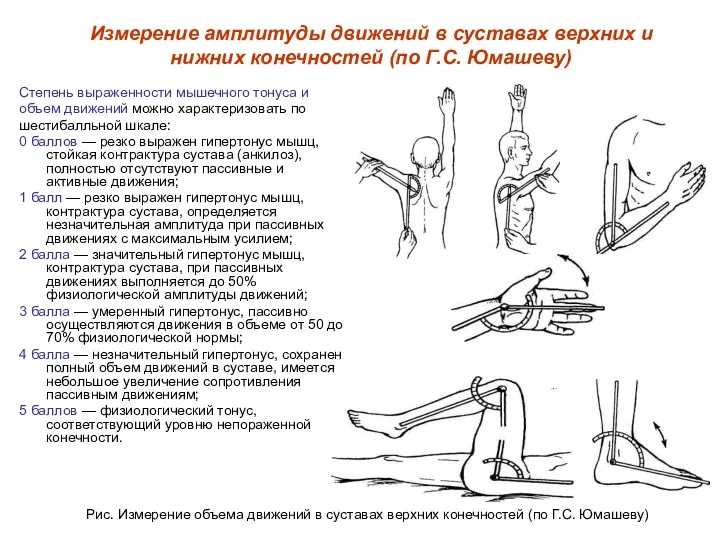 Степень выраженности мышечного тонуса и объем движений можно характеризовать по