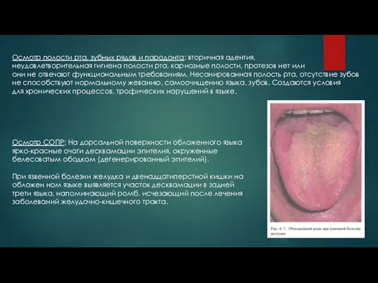 Осмотр полости рта, зубных рядов и пародонта: вторичная адентия, неудовлетвори­тельная