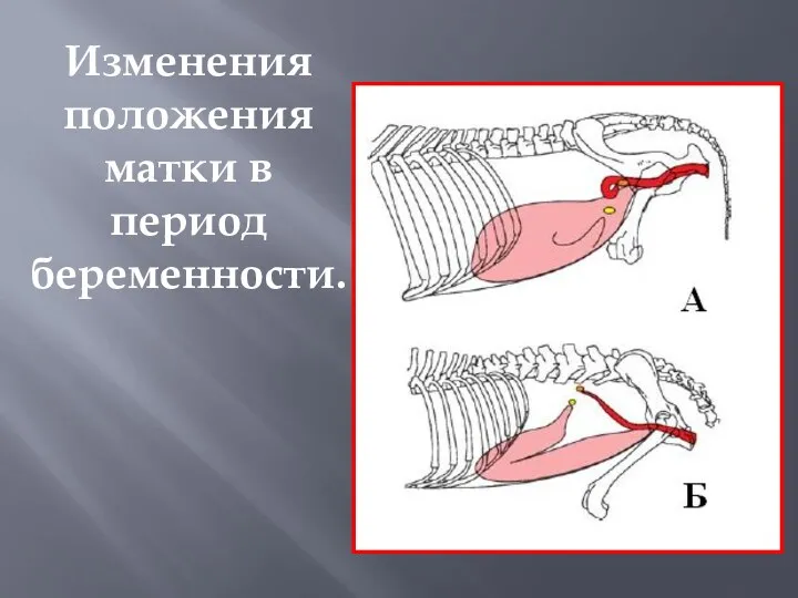 Изменения положения матки в период беременности.