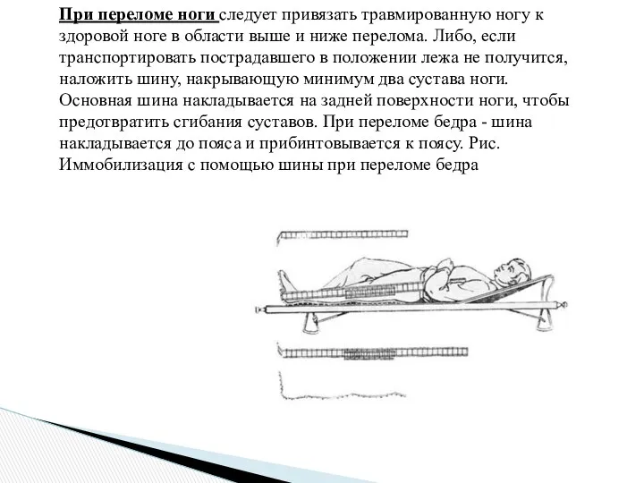 При переломе ноги следует привязать травмированную ногу к здоровой ноге